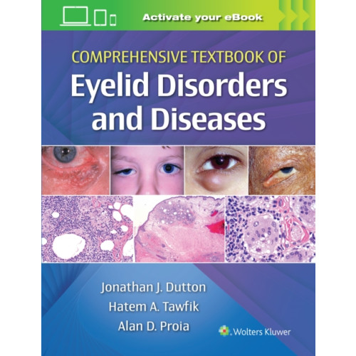 Wolters Kluwer Health Comprehensive Textbook of Eyelid Disorders and Diseases (inbunden, eng)