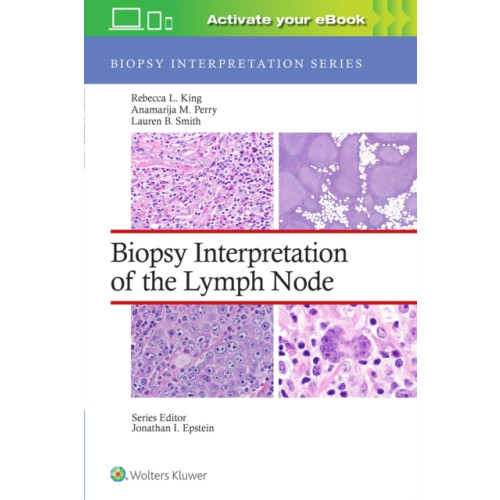 Wolters Kluwer Health Biopsy Interpretation of the Lymph Node: Print + eBook with Multimedia (inbunden, eng)