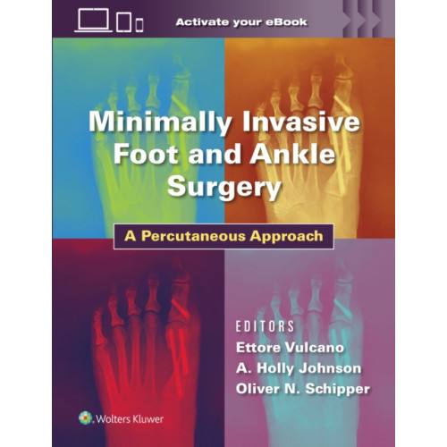 Wolters Kluwer Health Minimally Invasive Foot and Ankle Surgery (inbunden, eng)