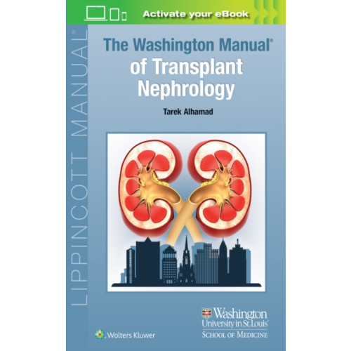 Wolters Kluwer Health The Washington Manual of Transplant Nephrology (häftad, eng)