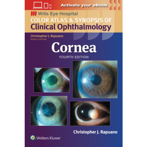 Wolters Kluwer Health Cornea: Print + eBook with Multimedia (häftad, eng)