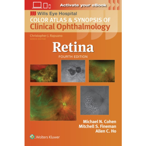 Wolters Kluwer Health Retina (häftad, eng)