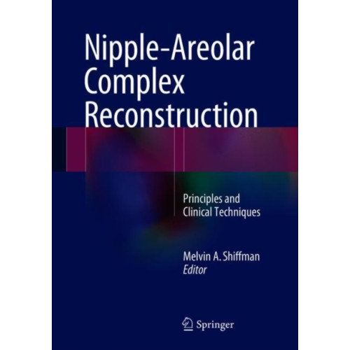 Springer International Publishing AG Nipple-Areolar Complex Reconstruction (inbunden, eng)