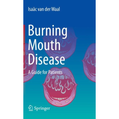 Springer Nature Switzerland AG Burning Mouth Disease (inbunden, eng)