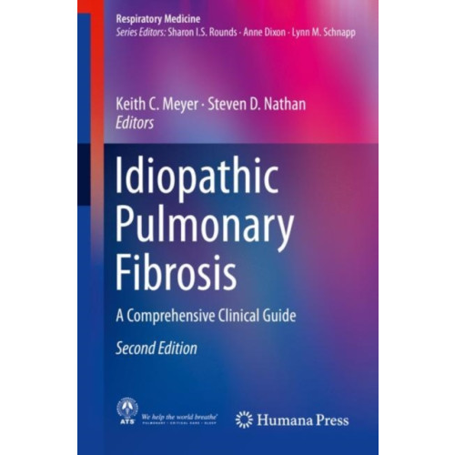 Birkhauser Verlag AG Idiopathic Pulmonary Fibrosis (inbunden, eng)