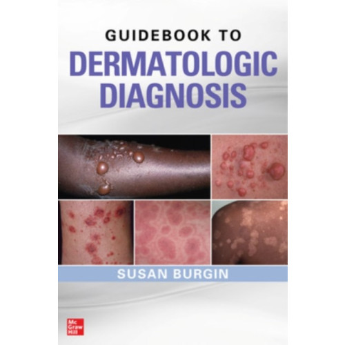 McGraw-Hill Education - Europe Guidebook to Dermatologic Diagnosis (häftad, eng)