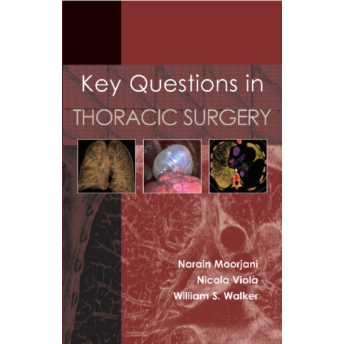 TFM Publishing Ltd Key Questions in Thoracic Surgery (häftad, eng)