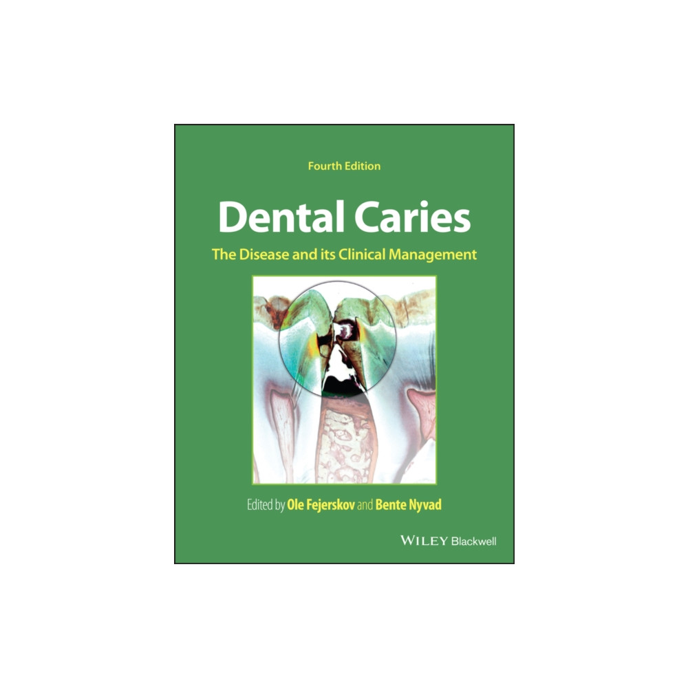 Produktbild för Dental Caries (inbunden, eng)