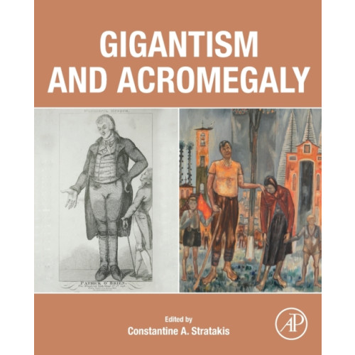 Elsevier Science Publishing Co Inc Gigantism and Acromegaly (häftad, eng)