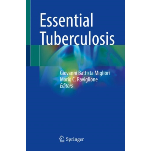 Springer Nature Switzerland AG Essential Tuberculosis (häftad, eng)