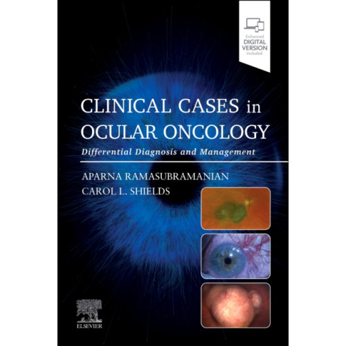 Elsevier Health Sciences Clinical Cases in Ocular Oncology (häftad, eng)