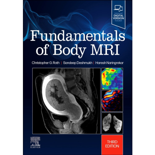 Elsevier - Health Sciences Division Fundamentals of Body MRI (häftad, eng)