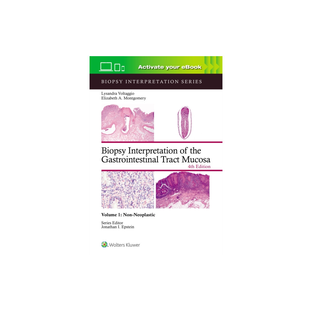 Produktbild för Biopsy Interpretation of the Gastrointestinal Tract Mucosa Volume 1 (inbunden, eng)
