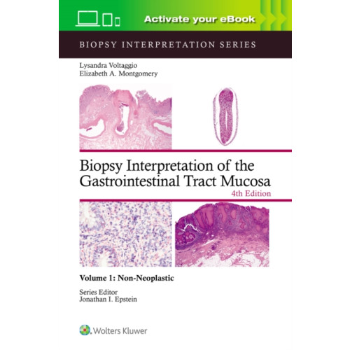 Wolters Kluwer Health Biopsy Interpretation of the Gastrointestinal Tract Mucosa Volume 1 (inbunden, eng)