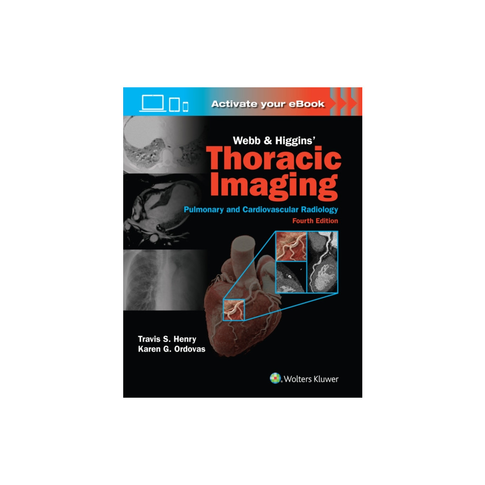 Produktbild för Webb & Higgins Thoracic Imaging: Print + eBook with Multimedia (inbunden, eng)