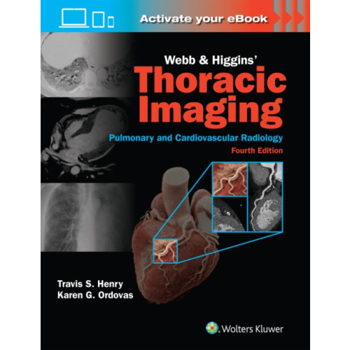 Wolters Kluwer Health Webb & Higgins Thoracic Imaging: Print + eBook with Multimedia (inbunden, eng)