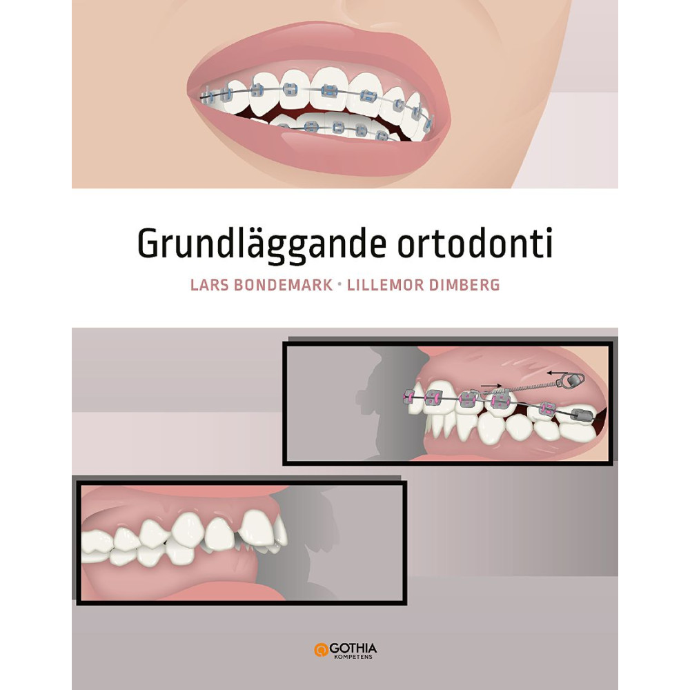 Produktbild för Grundläggande ortodonti (häftad)