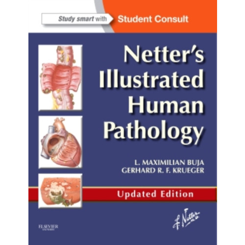 Elsevier - Health Sciences Division Netter's Illustrated Human Pathology Updated Edition (häftad, eng)