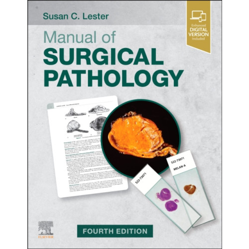 Elsevier - Health Sciences Division Manual of Surgical Pathology (häftad, eng)