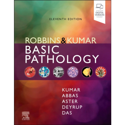 Elsevier - Health Sciences Division Robbins & Kumar Basic Pathology (inbunden, eng)