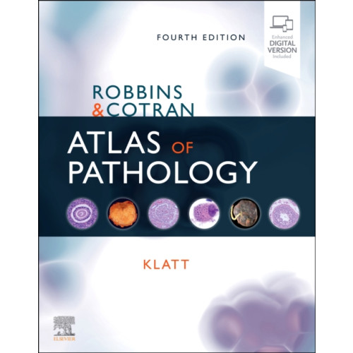 Elsevier - Health Sciences Division Robbins and Cotran Atlas of Pathology (häftad, eng)
