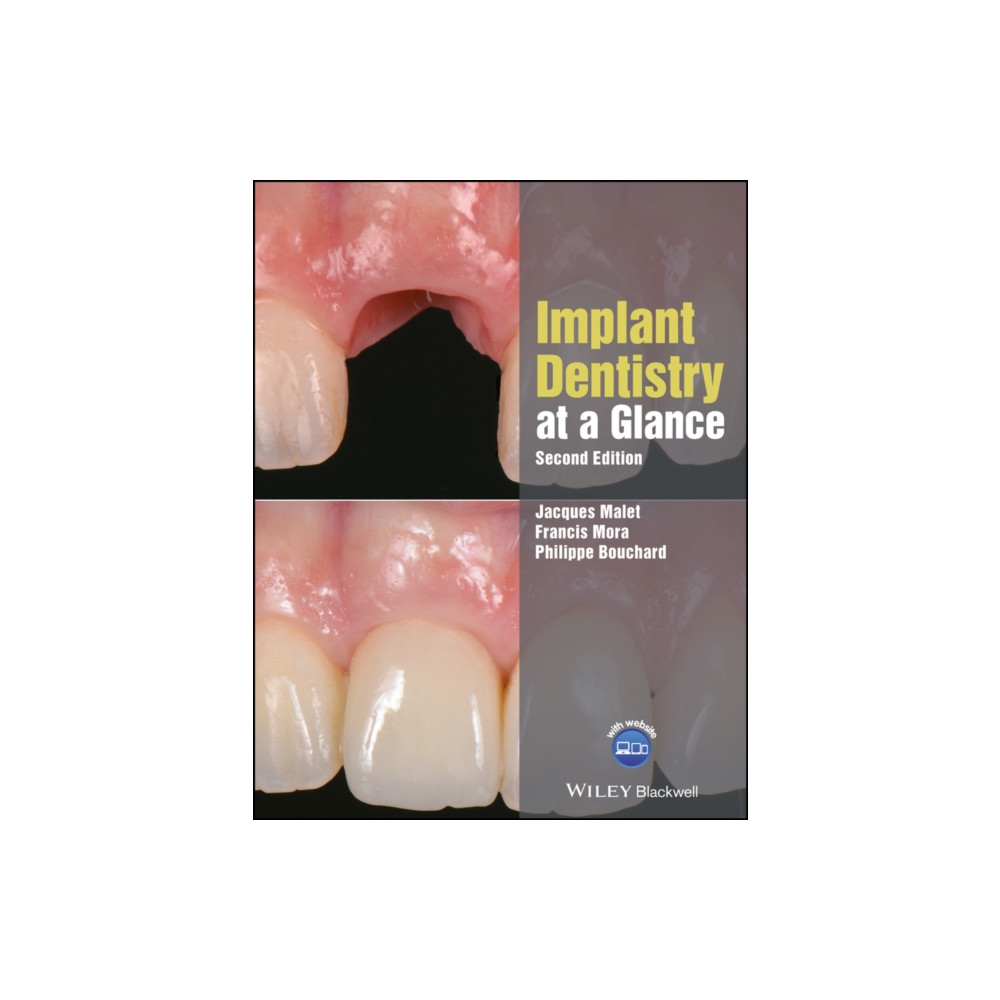 Produktbild för Implant Dentistry at a Glance (häftad, eng)