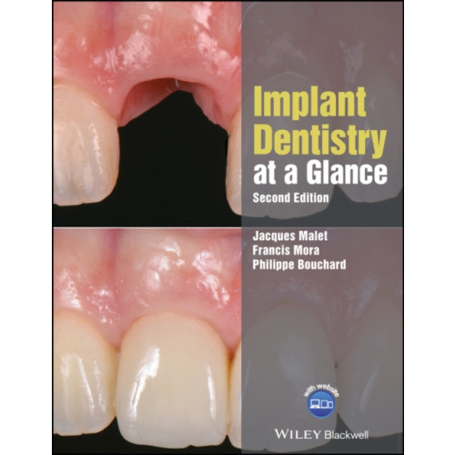 John Wiley And Sons Ltd Implant Dentistry at a Glance (häftad, eng)