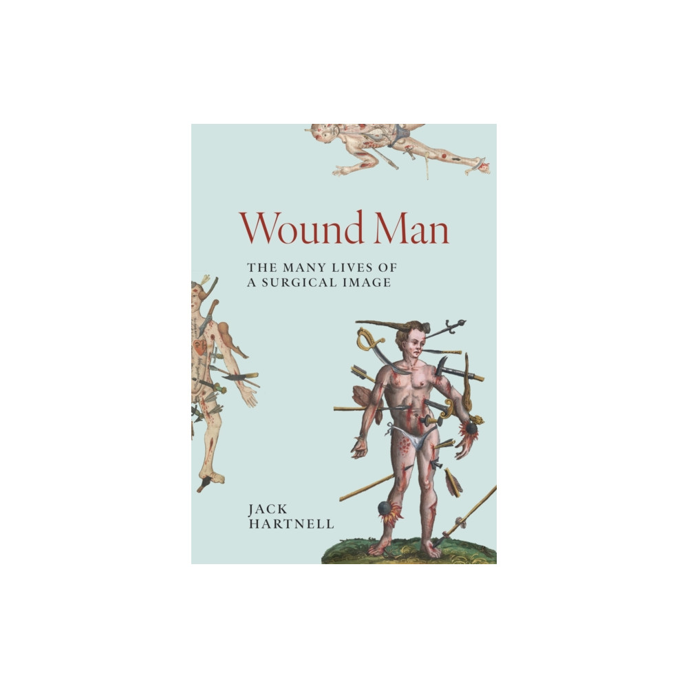 Produktbild för Wound Man (inbunden, eng)