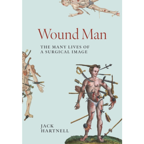 Princeton University Press Wound Man (inbunden, eng)
