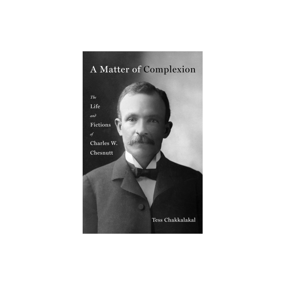 Produktbild för A Matter of Complexion (inbunden, eng)