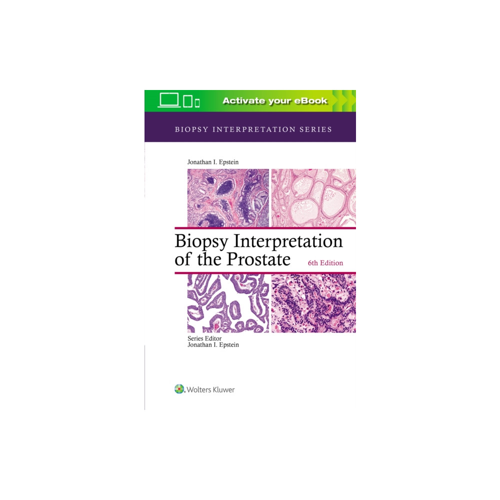 Produktbild för Biopsy Interpretation of the Prostate (inbunden, eng)