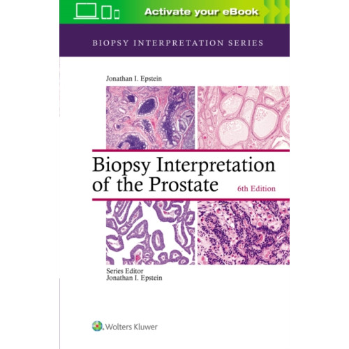 Wolters Kluwer Health Biopsy Interpretation of the Prostate (inbunden, eng)