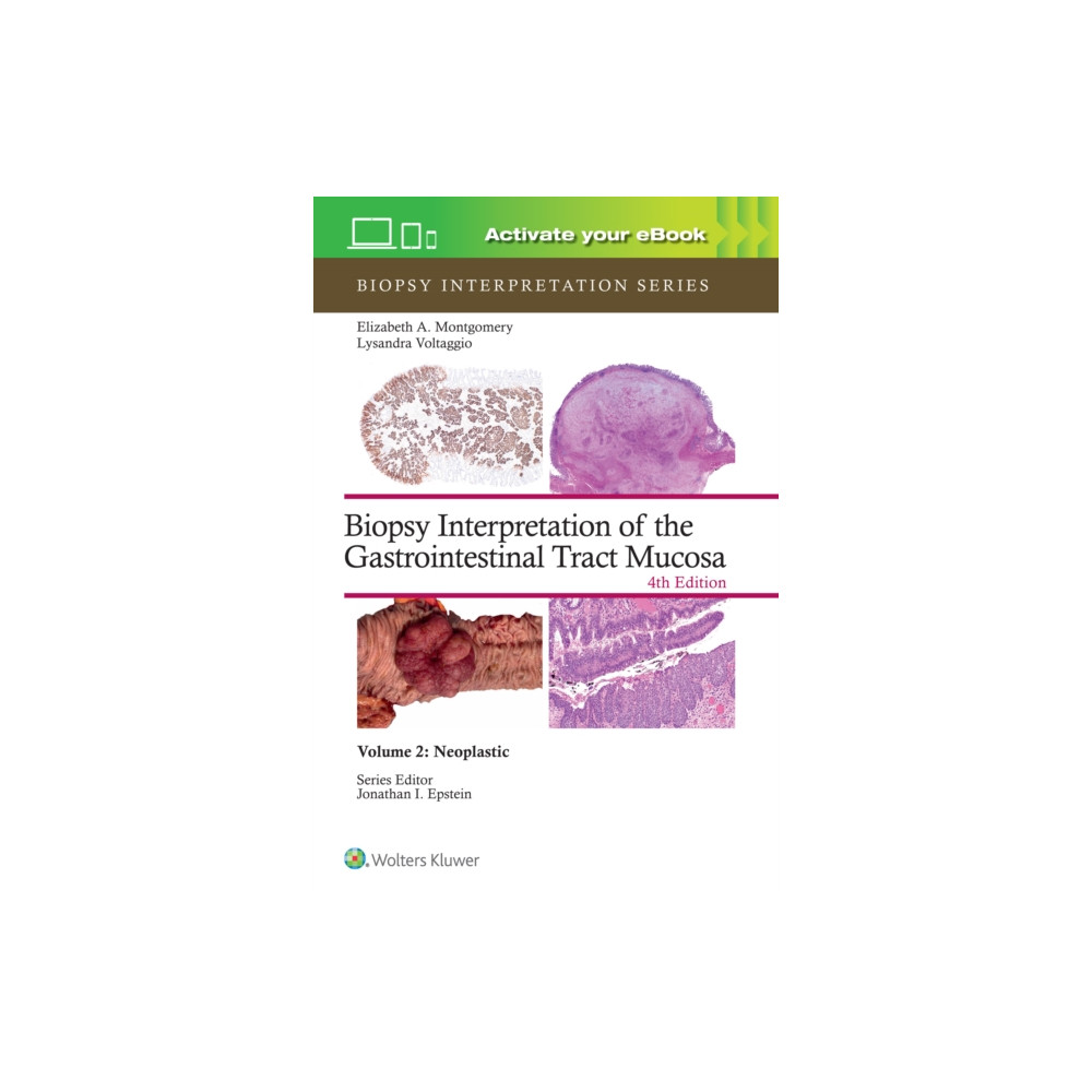 Produktbild för Biopsy Interpretation of the Gastrointestinal Tract Mucosa Volume 2 (inbunden, eng)