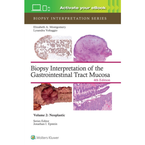 Wolters Kluwer Health Biopsy Interpretation of the Gastrointestinal Tract Mucosa Volume 2 (inbunden, eng)