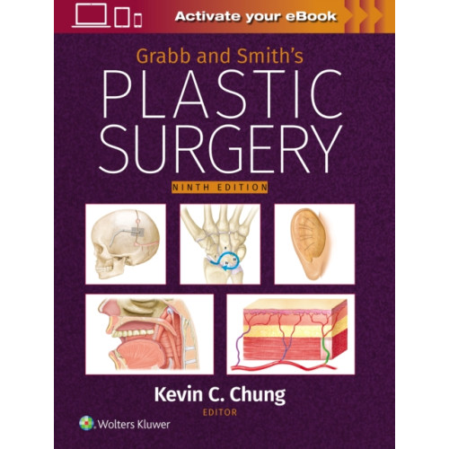 Wolters Kluwer Health Grabb and Smith's Plastic Surgery: Print + eBook with Multimedia (inbunden, eng)
