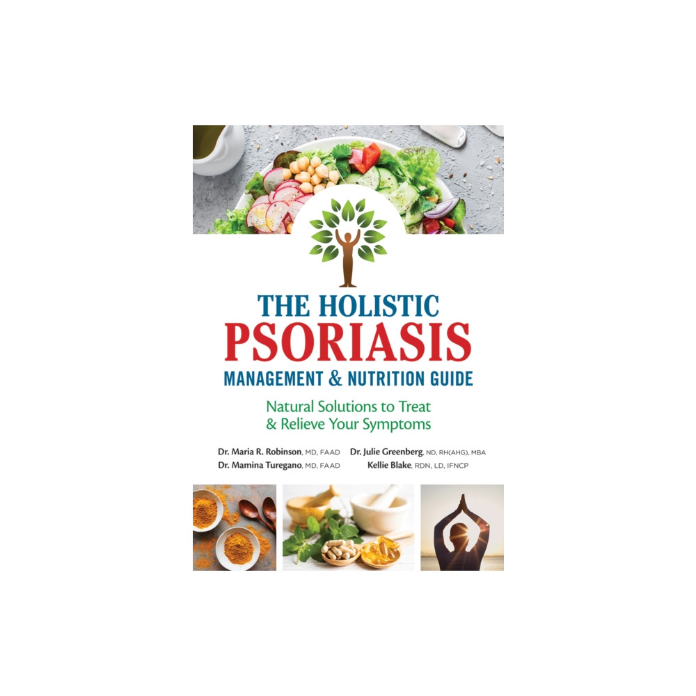 Produktbild för The Holistic Psoriasis Management and Nutrition Guide (häftad, eng)