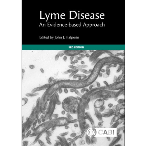 CABI Publishing Lyme Disease (inbunden, eng)