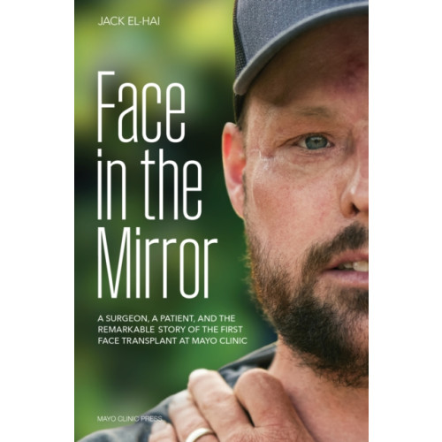 Taylor & francis ltd Face Transplant (inbunden, eng)