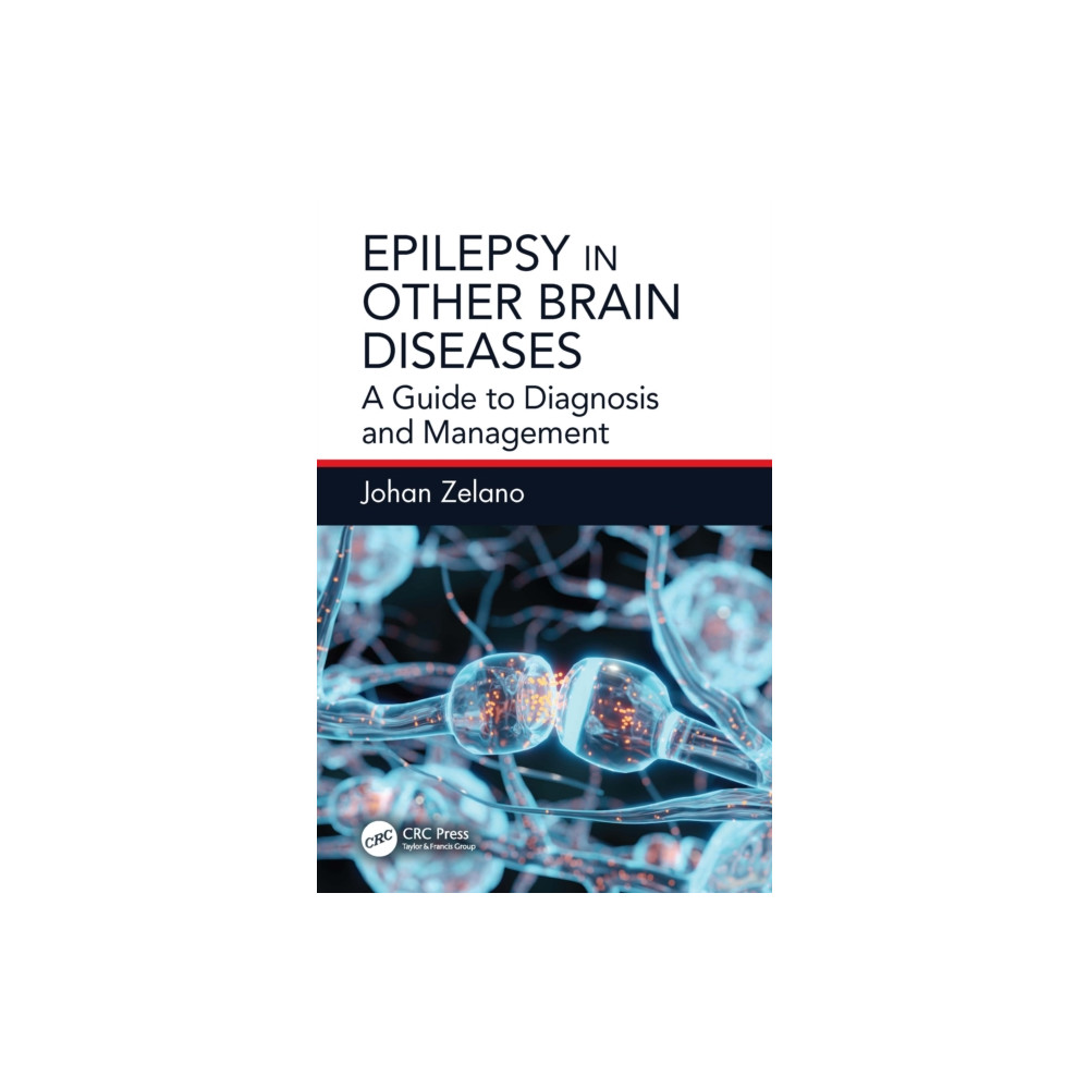 Produktbild för Epilepsy in Other Brain Diseases (häftad, eng)