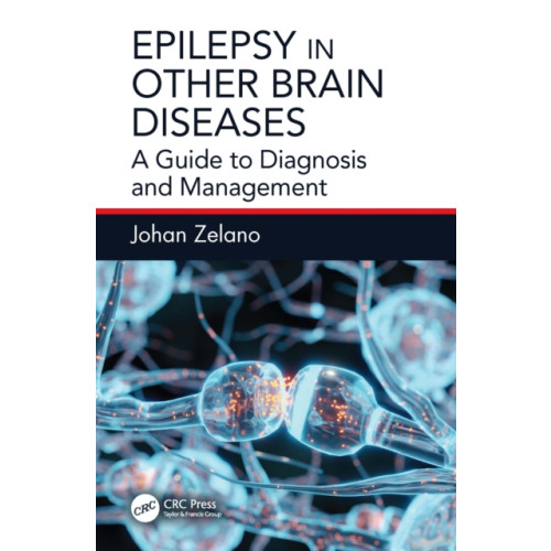 Taylor & francis ltd Epilepsy in Other Brain Diseases (häftad, eng)