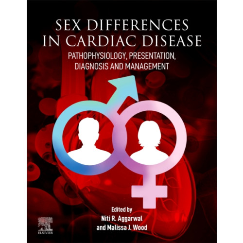 Elsevier Science Publishing Co Inc Sex differences in Cardiac Diseases (häftad, eng)