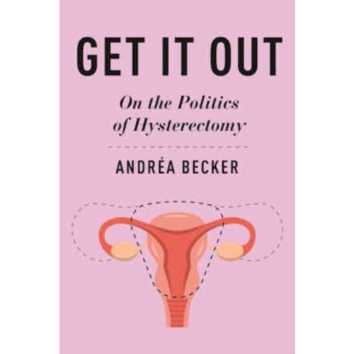 New York University Press Get It Out (häftad, eng)
