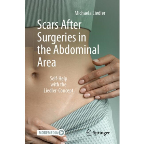 Springer-Verlag Berlin and Heidelberg GmbH & Co. KG Scars After Surgeries in the Abdominal Area (häftad, eng)