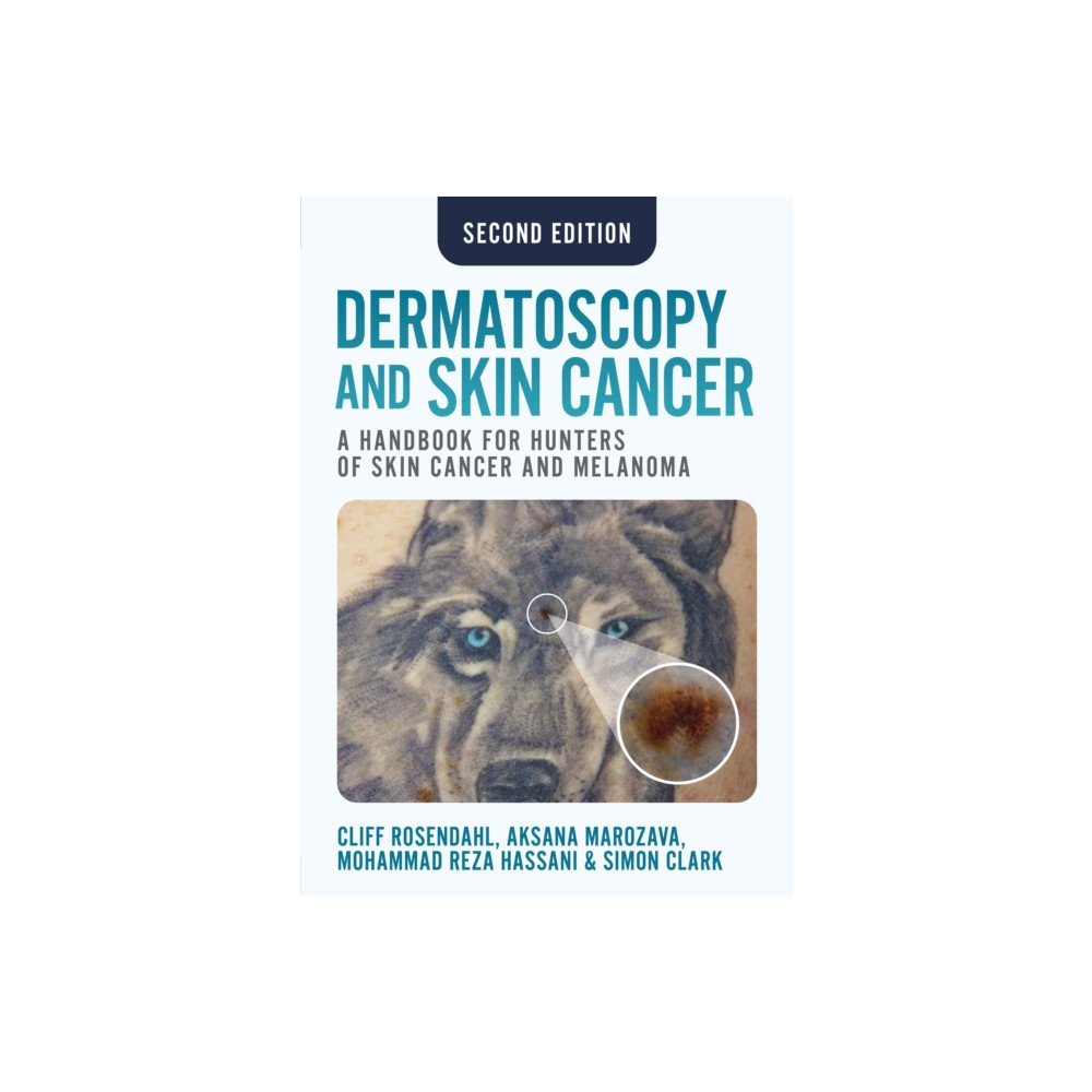 Produktbild för Dermatoscopy and Skin Cancer, second edition (häftad, eng)