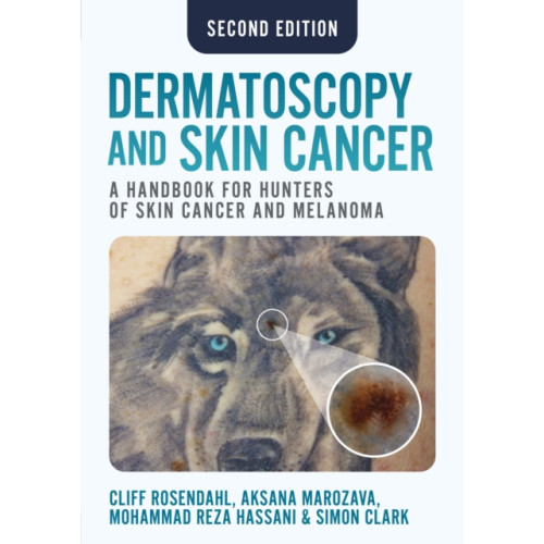 Scion Publishing Ltd Dermatoscopy and Skin Cancer, second edition (häftad, eng)