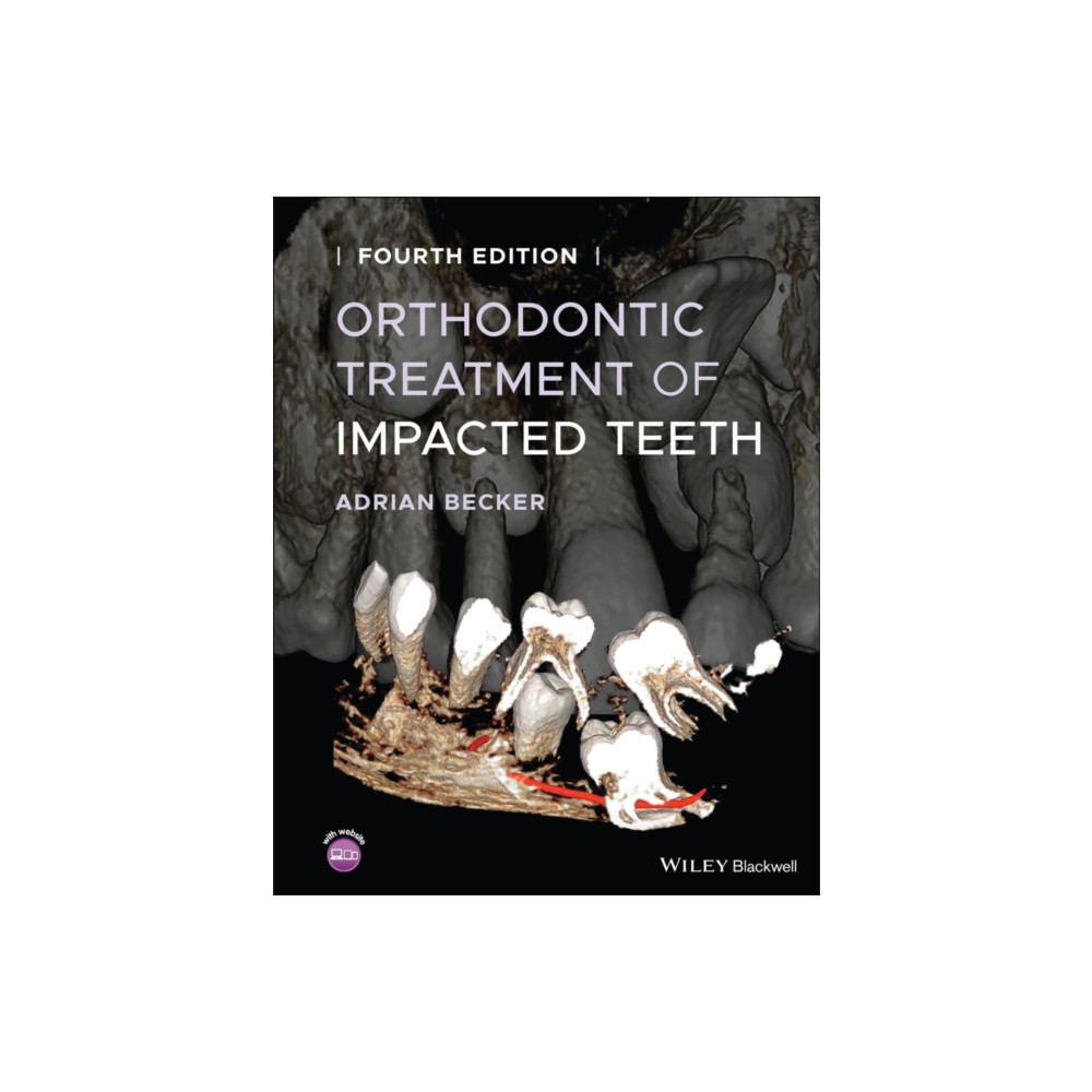 Produktbild för Orthodontic Treatment of Impacted Teeth (inbunden, eng)