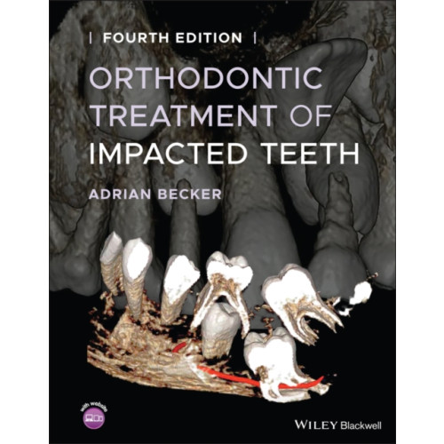 John Wiley And Sons Ltd Orthodontic Treatment of Impacted Teeth (inbunden, eng)