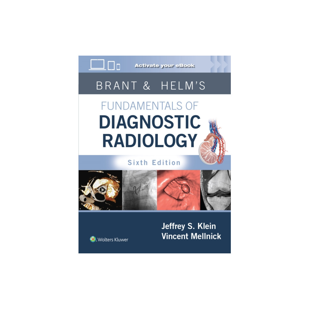 Produktbild för Brant & Helms' Fundamentals of Diagnostic Radiology: Print + eBook with Multimedia (inbunden, eng)