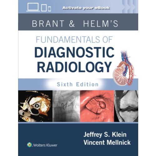 Wolters Kluwer Health Brant & Helms' Fundamentals of Diagnostic Radiology: Print + eBook with Multimedia (inbunden, eng)