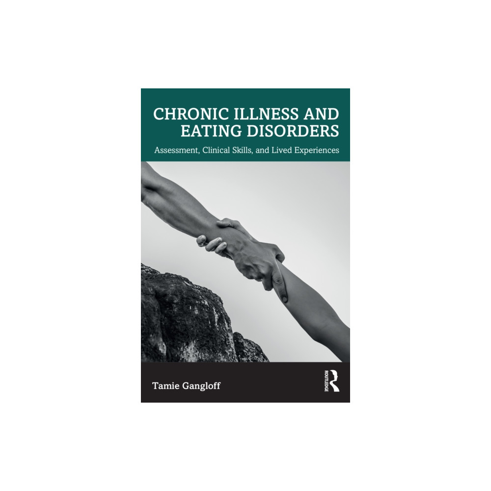 Produktbild för Chronic Illness and Eating Disorders (häftad, eng)